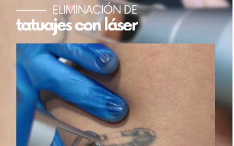 Imagen de galería
